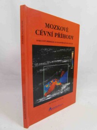 Polívka, Jiří, Ševčík, Petr, Mozkové cévní příhody: Stručný přehled o ischemických iktech, 2000